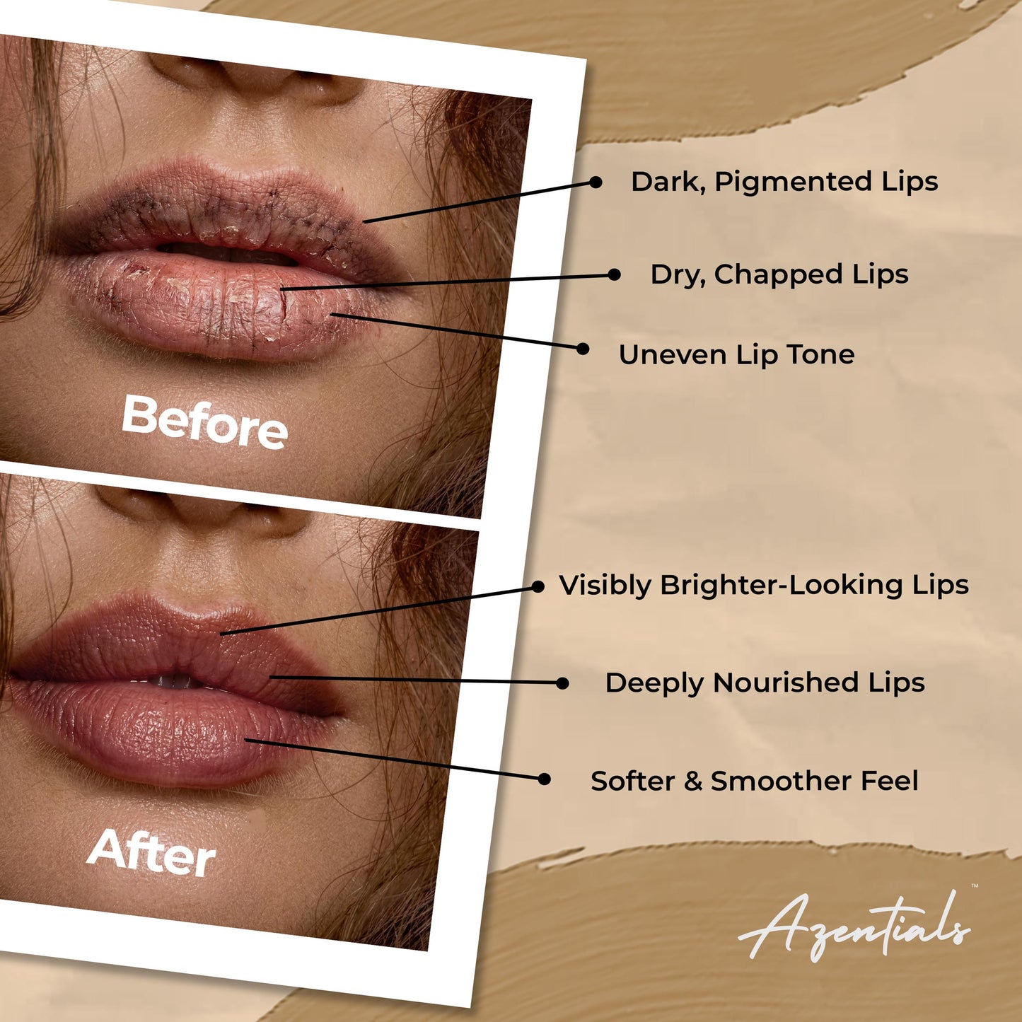 Barrier Kiss Lip Balm SPF 50 PA++++ | Advanced Lip Repair Balm for Dry & Pigmented Lips | Broad Spectrum Sun Protection | With Hyaluronic Acid, Ceramide & Squalene | For Men & Women